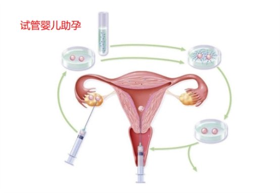 去格鲁吉亚巴统做试管需要提前多久备孕?