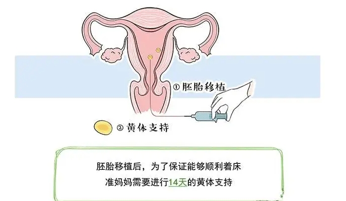 腺肌症：胚胎移植的“隐形杀手”?