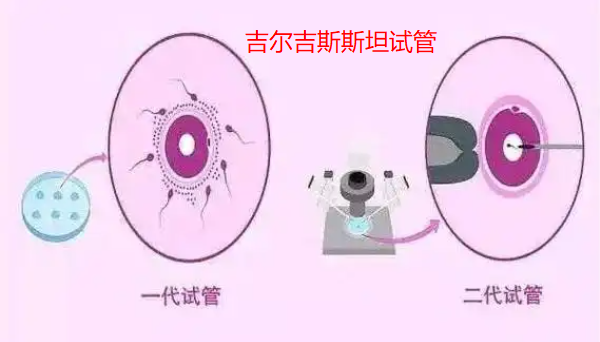 去吉尔吉斯斯坦做试管前如何把身体调理到最佳状态