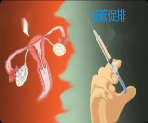 试管促排周期是 14 天么?