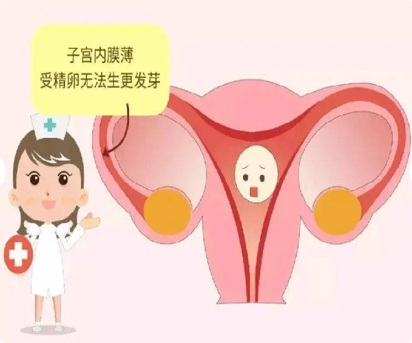内膜薄：39岁李女士内膜3毫米通过俄罗斯合法第三方辅助生殖助孕成功