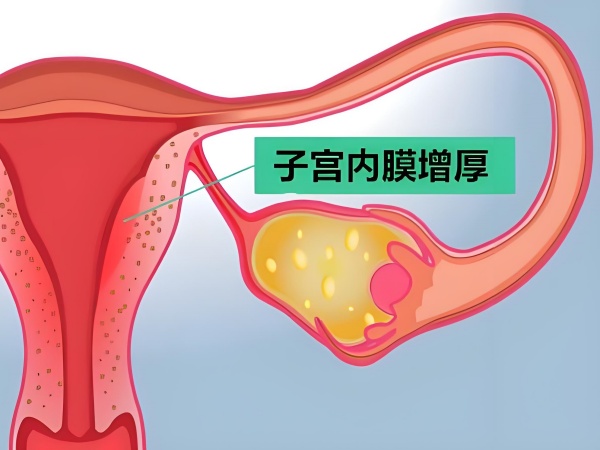 a7813035-db1c-4674-b5a2-de3d02b73c63.jpg