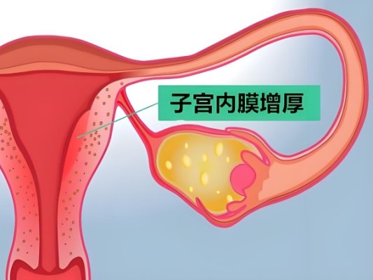 移植前内膜厚需要取消周期吗?