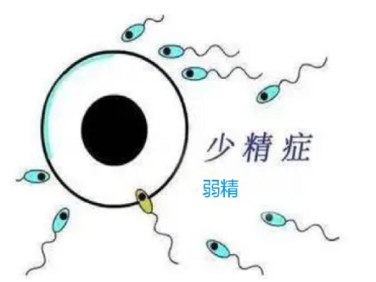 少精弱精对吉尔吉斯斯坦试管婴儿成功率有哪些影响?
