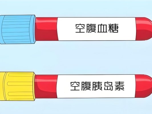 哪些情况促排前需要做胰岛素抵抗
